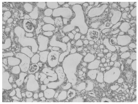 Série Introduction aux impuretés foliques actives : ① Dévoilement de l'impact de l'acide 5-méthyltétrahydroptéroique.
